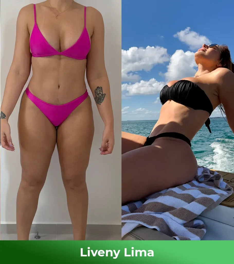 Antes e depois - Liveny Lima