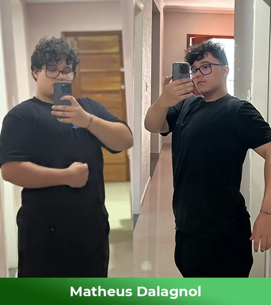 Antes e depois - Matheus Dalagnol